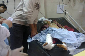 مدير مستشفى اسيوط الجامعى: تحسن حالتين من مصابى قطار اسيوط