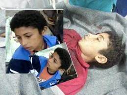 المتحدث العسكري: التقرير المبدئي يؤكد حدوث تسمم في دم”طفل البطاطا” بعد إصابته برصاص فشنك