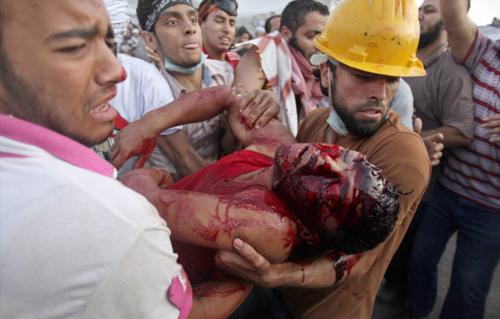 وزارة الصحة: وفاة ٢٠ و إصابة ١٧٧ فى اشتباكات بين الشرطة ومؤيدى المعزول بطريق النصر فجر اليوم