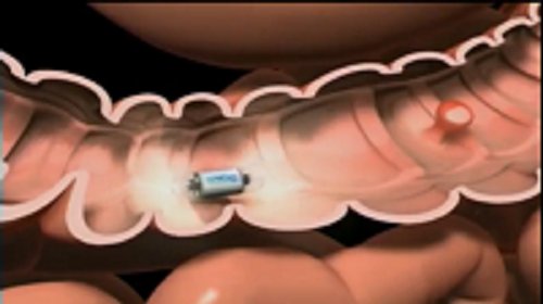كاميرا بحجم حبة الدواء لكشف الأمراض