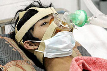 وفاة ثانى حالة إشتباه بانفلونزا الخنازير بالقليوبية