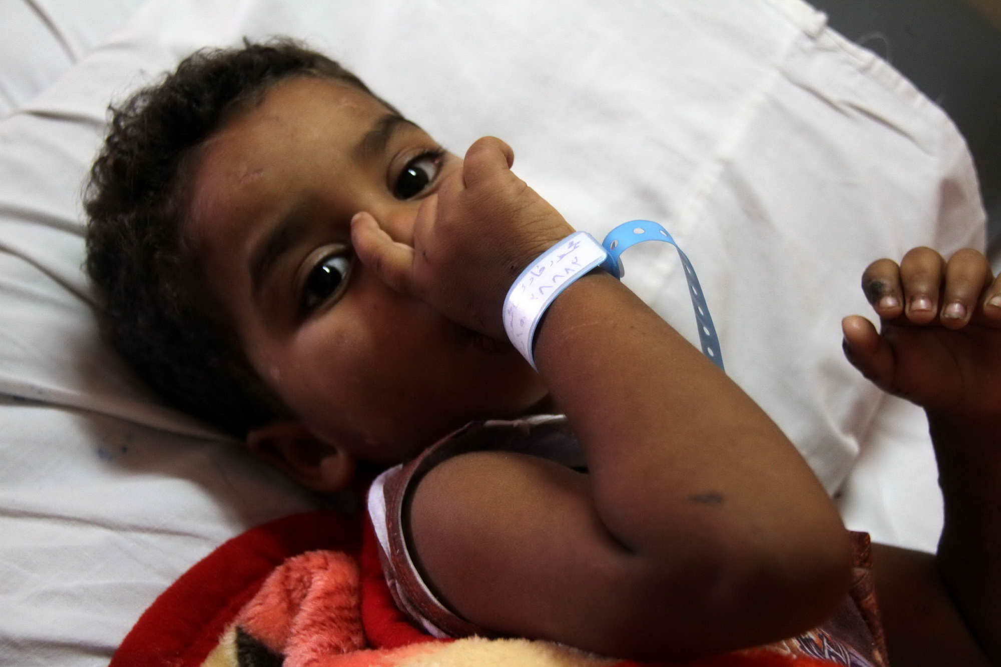 مصابين غزة فى معهد ناصر