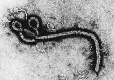 ما هو المصل السري الذي ربما أنقذ حياة الأمريكيين مصابي “إيبولا”