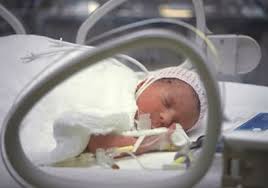 “ابفى” ترعى ورشة عمل لعلاج مشاكل الاطفال المبتسرين