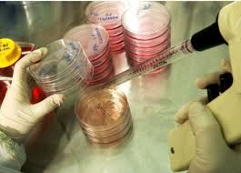 تقنية تجميد البويضات