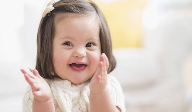 “Down syndrome Dream” يدعم أسر “متلازمة داون”