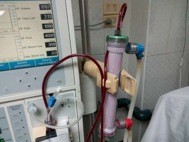 “فاركوماك” للصناعات الطبية تنشئ مصنعاً لـ”فلاتر الكلى” بـ100 مليون جنيه