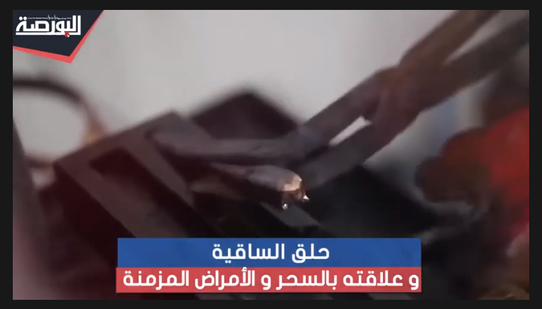 حلق الساقية وعلاقته بالسحر والأمراض المزمنة "حكاوى الذهب فى مصر (2)"