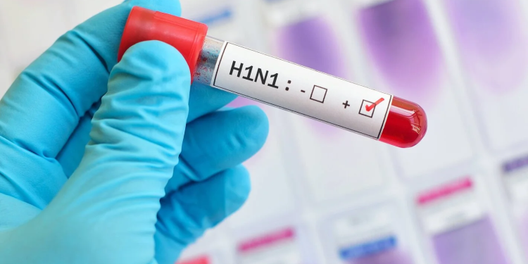 إنفلونزا الخنازير