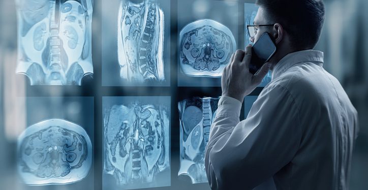 استخدام الذكاء الاصطناعي في التصوير الطبي