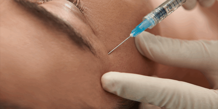 حقن البوتوكس