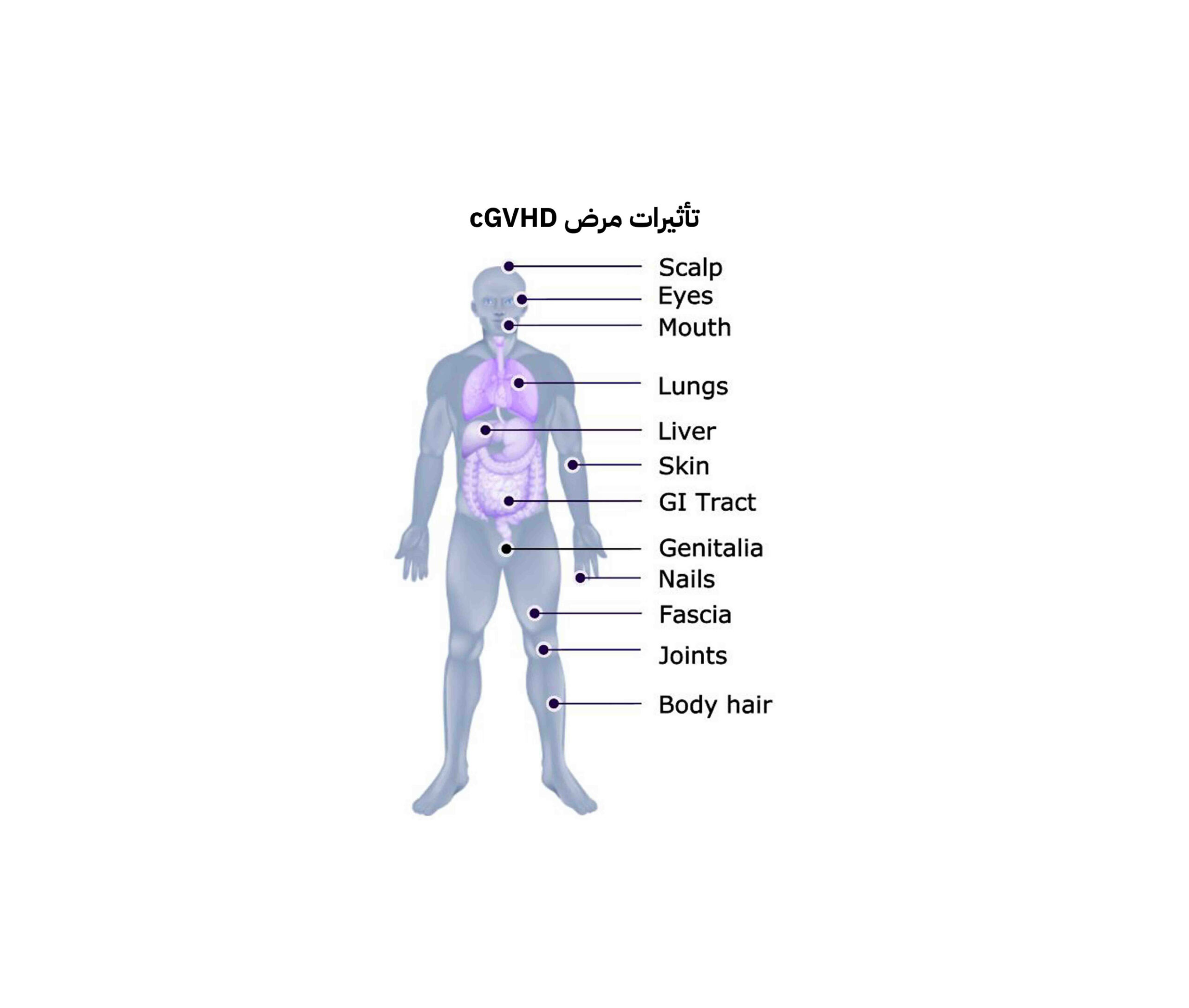 ما بعد زراعة النخاع العظمي؟