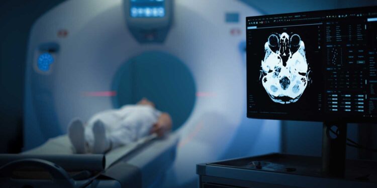 32 مليون دولار حجم استهلاك مصر من صبغات الأشعة.. وتوجهات لتوطينها